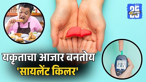 A Liver Disease is Silently Killing Millions | Metabolic Dysfunction-Associated Steatotic Liver Disease