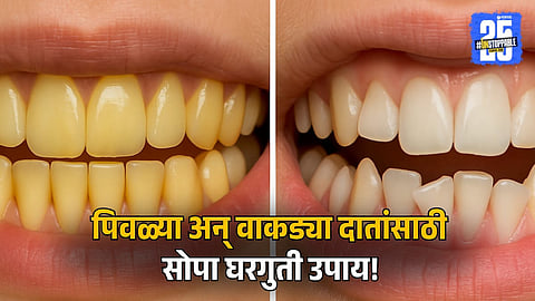 Home Remedies for Yellow and Crooked Teeth