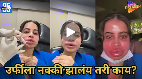 Urfi Javed lip filler removal full video Viral 