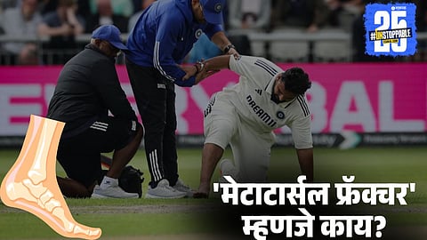 Rishabh Pant metatarsal fracture injury 

