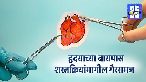 Facts about Bypass Surgery You Must Know Before You Panic