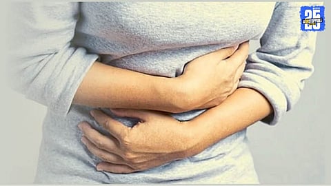 PCOS Hormonal Imbalance