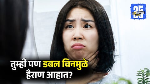 Home Remedies for Puffy Face and Bloated Cheeks