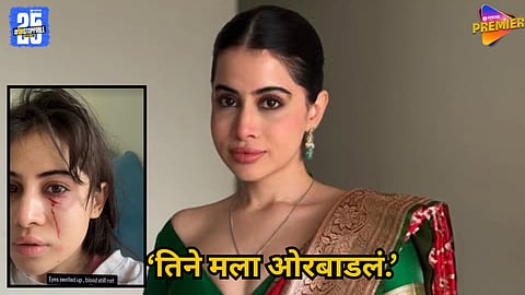 Urfi Javed viral video after cat accidentally scratched her face: