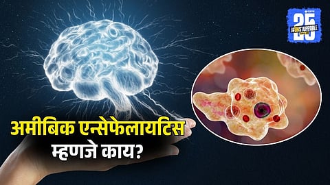 Everything to Know About Amoebic Encephalitis