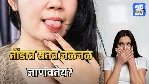 Causes And Remedies For Burning Mouth Syndrome