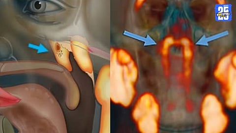 Scientists Discover New Organ in Human Body After 300 Years