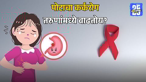 Stomach Cancer Among Young Adults