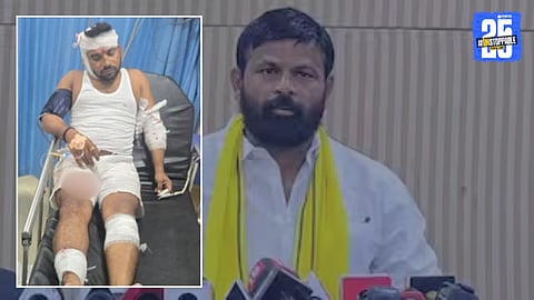 Laxman Hake: लक्ष्मण हाकेंच्या 'राईट हँड'ला बीडमध्ये बेदम मारहाण; ''ताणून मारेन'' म्हणत व्हिडीओ झाला होता व्हायरल