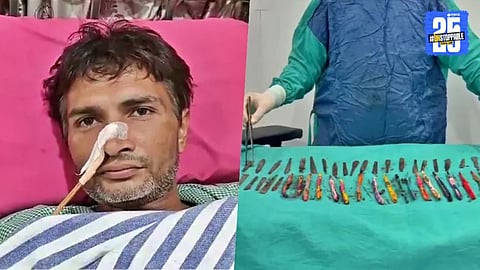 X-ray image showing multiple metallic objects, including spoons and pens, inside a patient's abdomen.