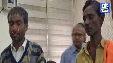 Crime News: नाक चाव्याची दहशत! उंदरासारख्या दातांनी अर्धा डझन लोकांची कुरतडली नाकं, जिल्हाधिकाऱ्यांकडे तक्रार