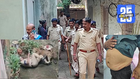 Kolhapur City Leopard Attack