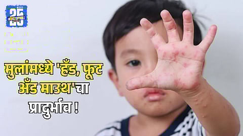 Hand, Foot, and Mouth Diseases in Children