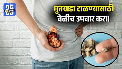 Kidney Stone Risk in Winter