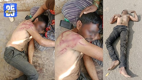 Gramsevak Attack Nadlagav Incident