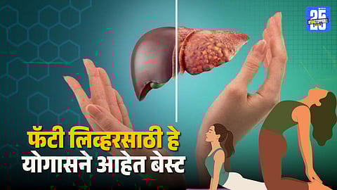 Simple Yoga Asanas to Relieve Fatty Liver