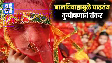 Child Marriage Impact on Girl's Health