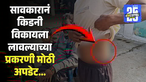 Chandrapur Farmer Forced to Sell Kidney Over Loan Trap