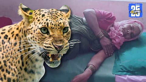 Leopard Attack in Satara