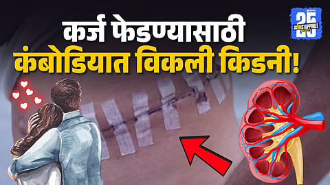 Kidney Trafficking Case