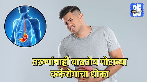 Stomach Cancer in Young Adults