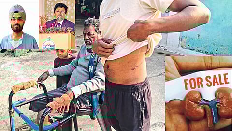 Kidney Sale Case Takes Political Turn as Doctors’ High-Profile Links Surface