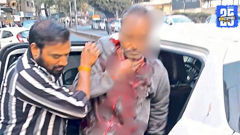 nylon manja accident