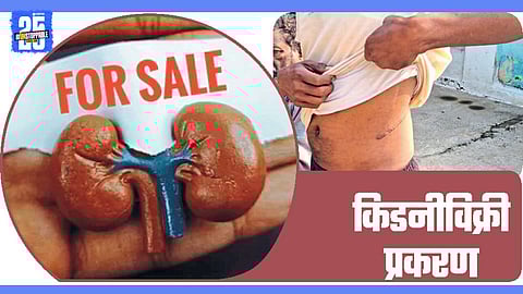 Kidney Sale Case