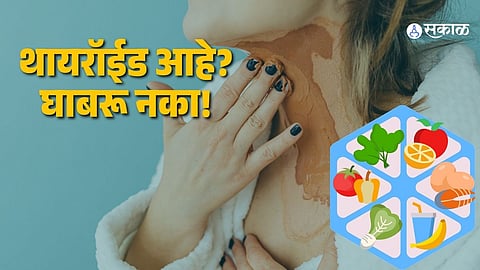 Thyroid Control Foods: 