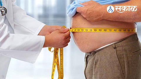 Obesity due to lifestyle changes