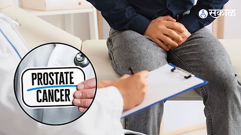 Prostate Cancer