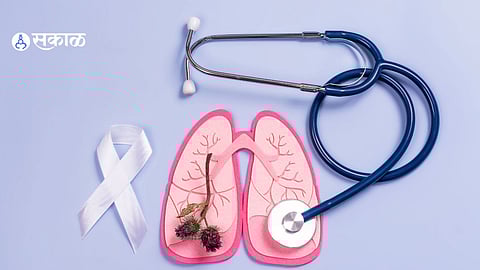 Pneumonia Cases: तापमान बदलाचा फटका; हवामान बदलामुळे सर्दी-खोकल्याचा प्रादुर्भाव, पुण्यात न्यूमोनियाच्या रुग्णांत वाढ!