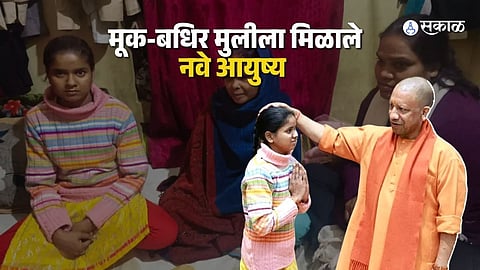 Emotional moment as a deaf-mute girl speaks for the first time after 19 years, with doctors and family present.