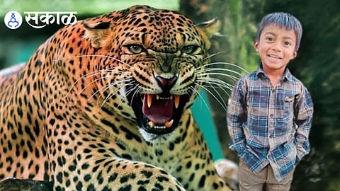 Leopard Attack Sangli Child