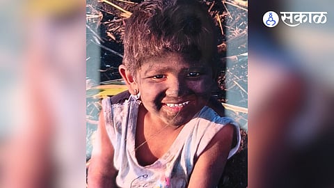 boy died in dog attack in bhor