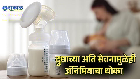 Anemia in Children on the Rise Due to High Milk Intake, Experts Say