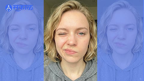 Hemifacial Spasm Symptoms