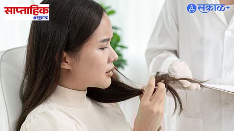 Hair Fall and Dandruff Solutions
