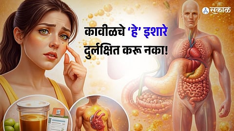 Jaundice Kavil Symtoms