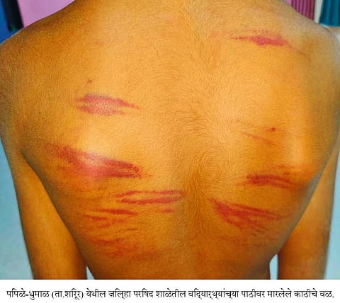 हिवरे कुंभार शाळेतील सात विद्यार्थ्यांना अमानुष मारहाण