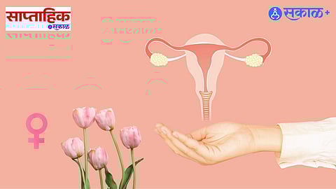 Menopause and Menstruation Health