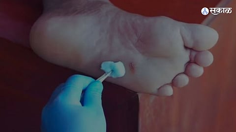 Show Cause Notice Issued