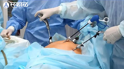 woman stomach surgery