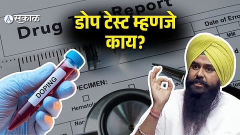 What is Dope Test&nbsp;