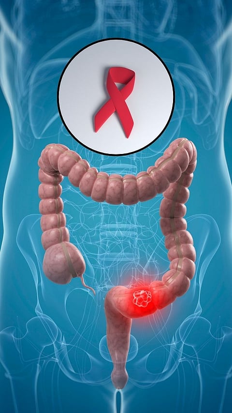 Cancer prevention habits 