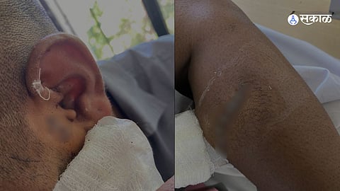 Youth Attacked with Sharp Weapon in Ghorpadi