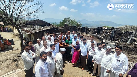 जळीत ग्रस्त कुटुंबातील सदस्यांना धिर देताना आमदार मांडेकर व इतर मान्यवर