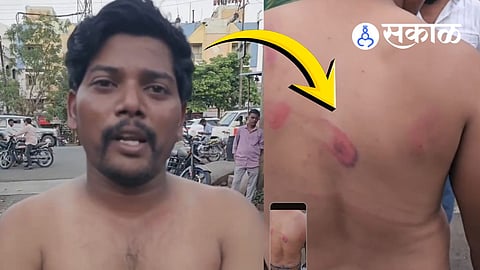 Brutal Assault on Pandharpur Driver in Isolated Area