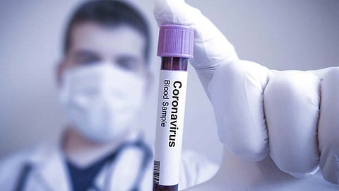 पिंपरी-चिंचवडकरांनो दिवसेंदिवस धोका वाढतोय; आजचा कोरोना पॉझिटिव्ह अन् मृत्यूंचा आकडा पाहा