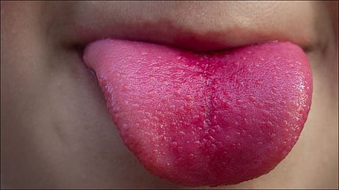 man cuts off wifes tongue after kiss at Ahmedabad. (Image Source: dailystar.co.uk)